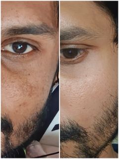 Dermatouch Bye Bye Pigmentation Face Wash - Image 9