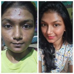 The Derma Co Sali-Cinamide Anti-Acne Face Wash - Image 7