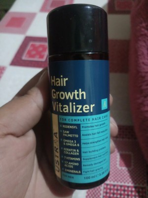 Share 144+ hair growth vitalizer review super hot