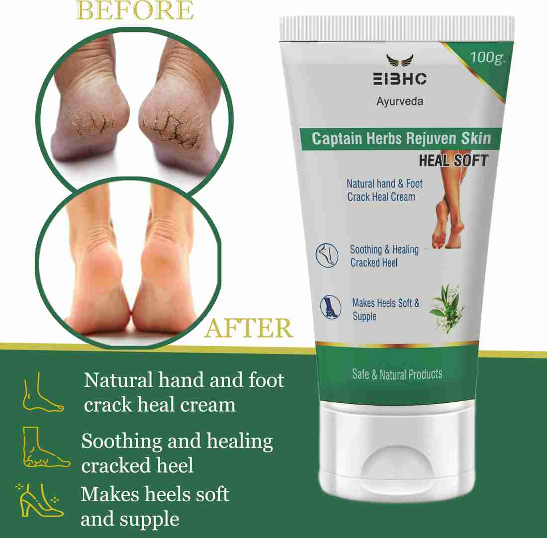 Ayurvedic cream for cracked heels outlet