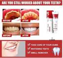 LORSHEL sp 4 toothpaste with quick whitening results in one week