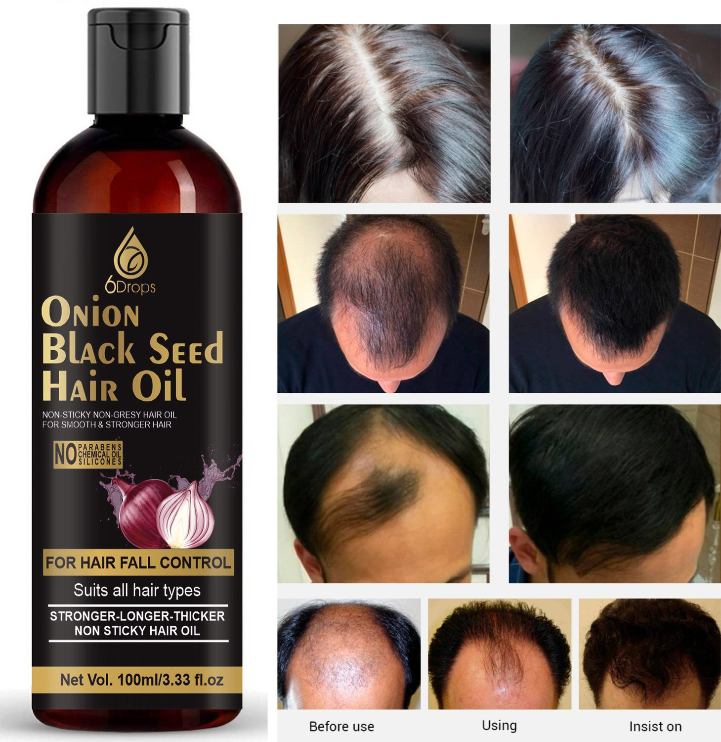 Image of HAIR & CARE Vloe Vera Oil 300X 1 Hair Oil (300 ml)