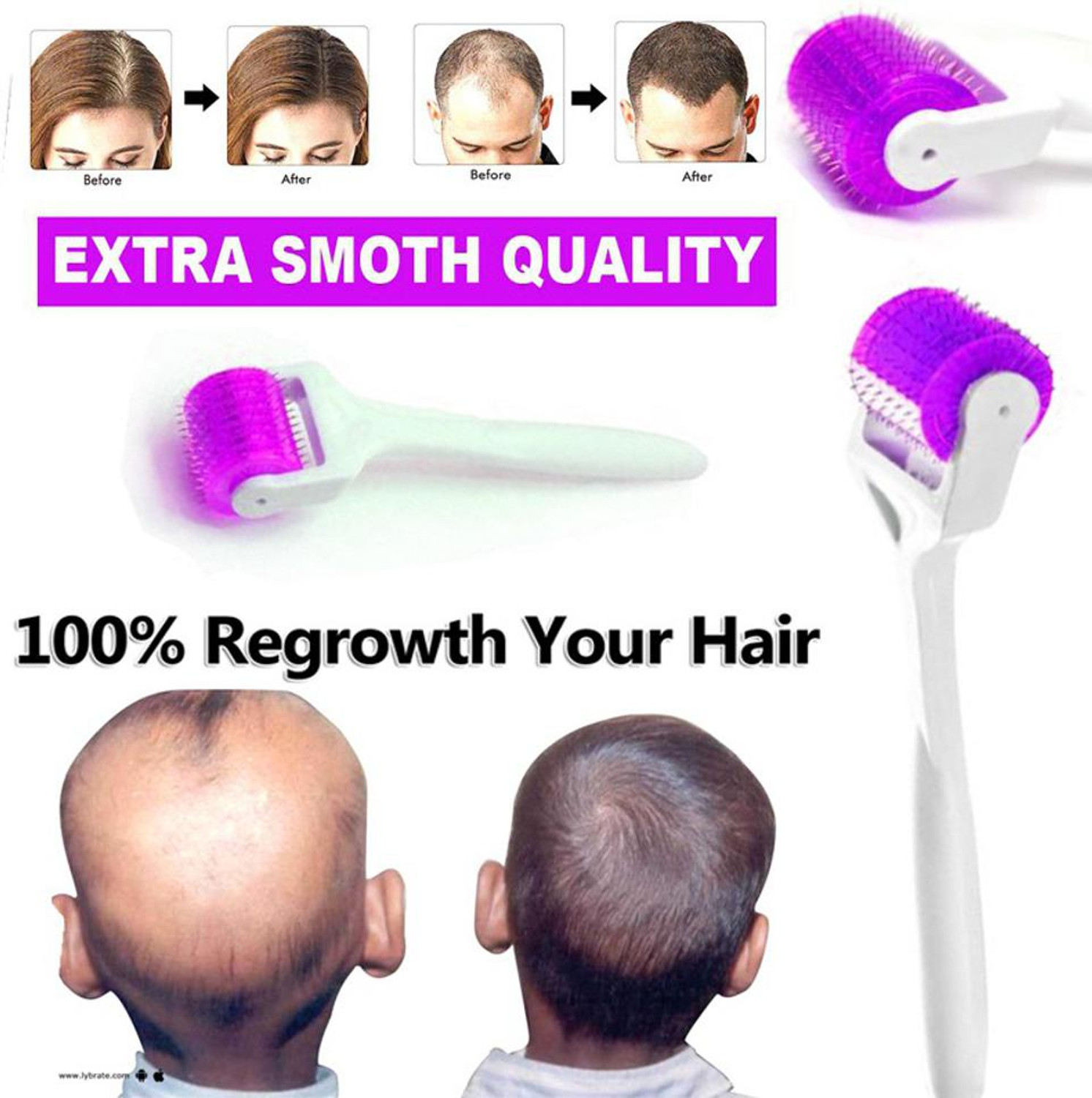 Image of scotbeauty Derma roller hair 0.5mm for Acne, Skin Hair Loss hair growth titanium roller (120 ml)