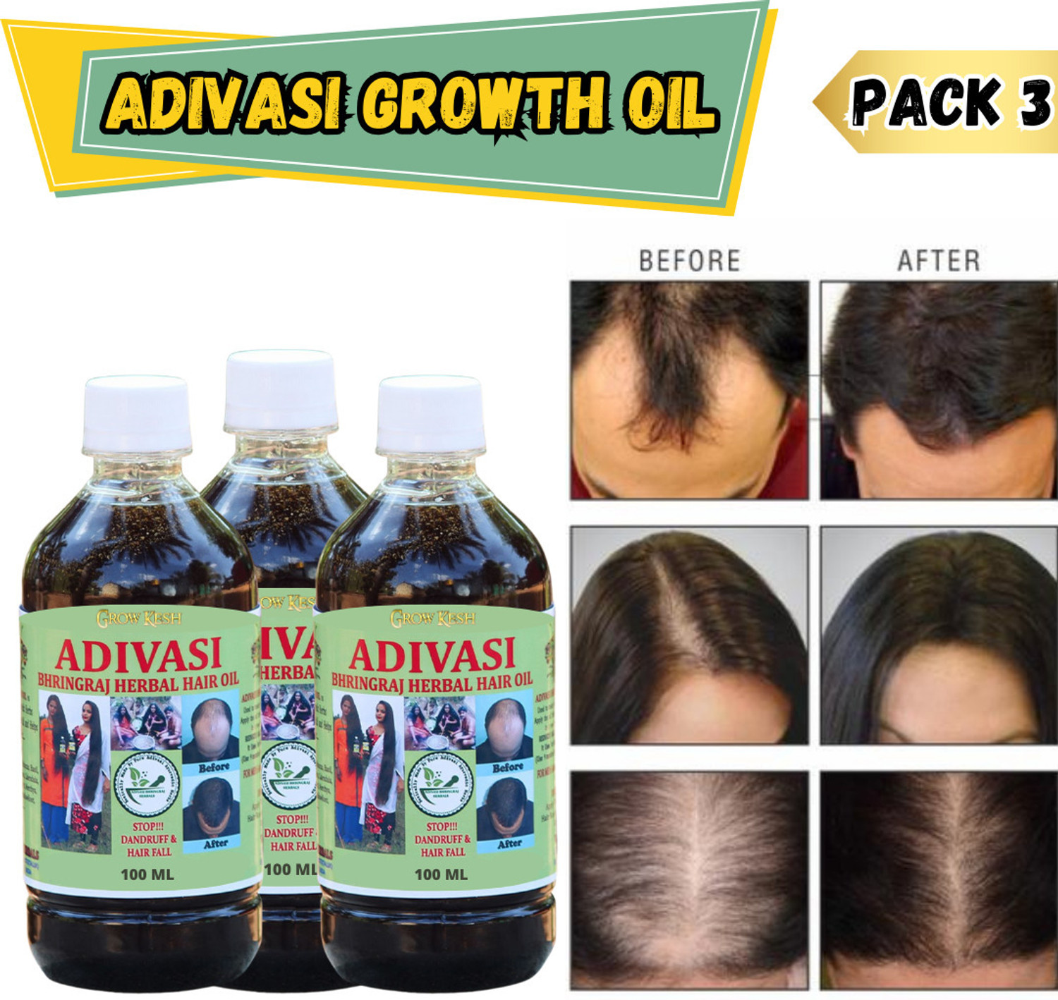 Image of VASMOL Super 33 Kesh Kala Oil Based Hair Colour - 4 x 100 ml Packs Hair Oil (400 ml)