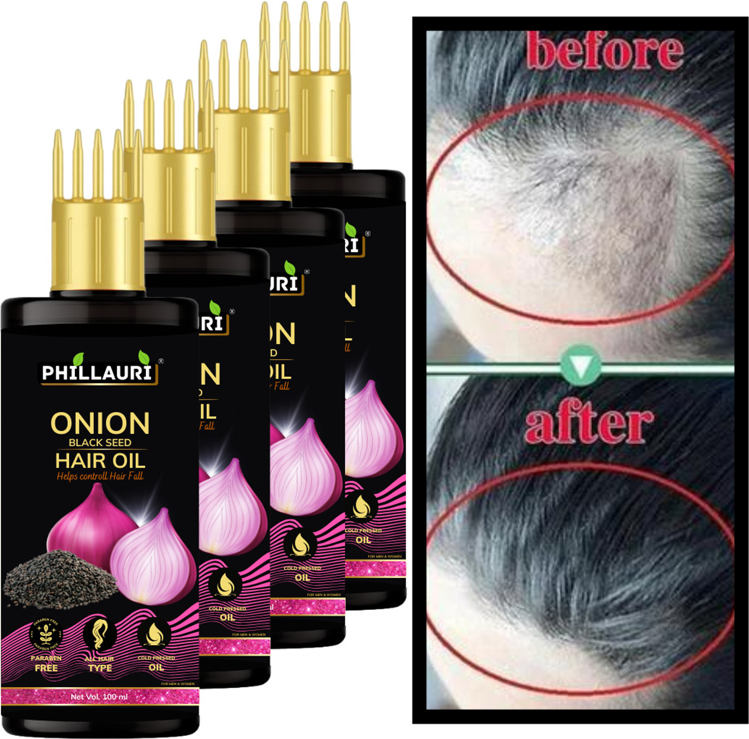 Image of N2B Onion Black Seed Hair Oil - Hair Oil (40 ml)