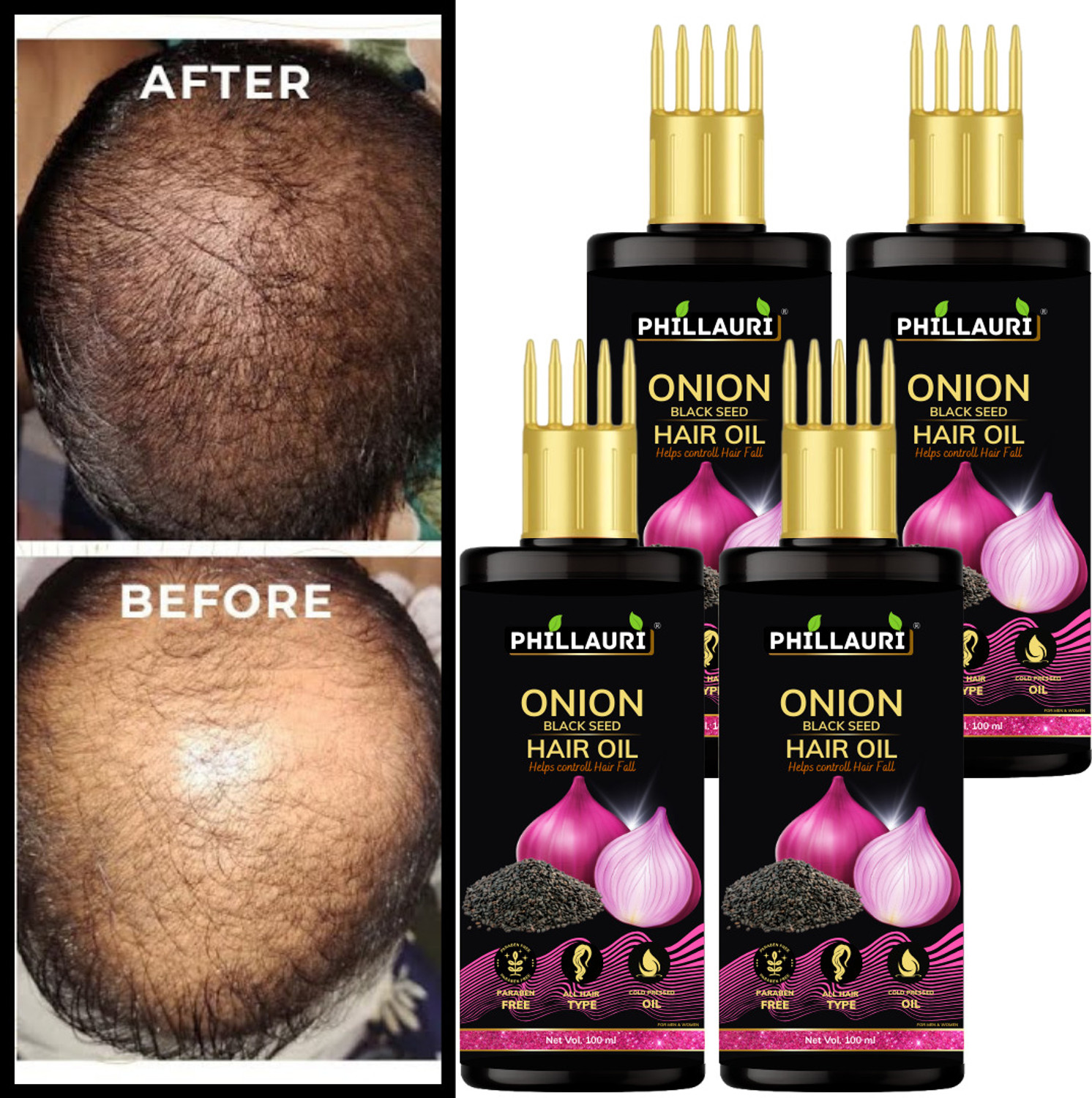 Image of groviva Complete Hair Solution | Helps to Control Hair Fall|100 ml (Pack of 2) Hair Oil (200 ml)