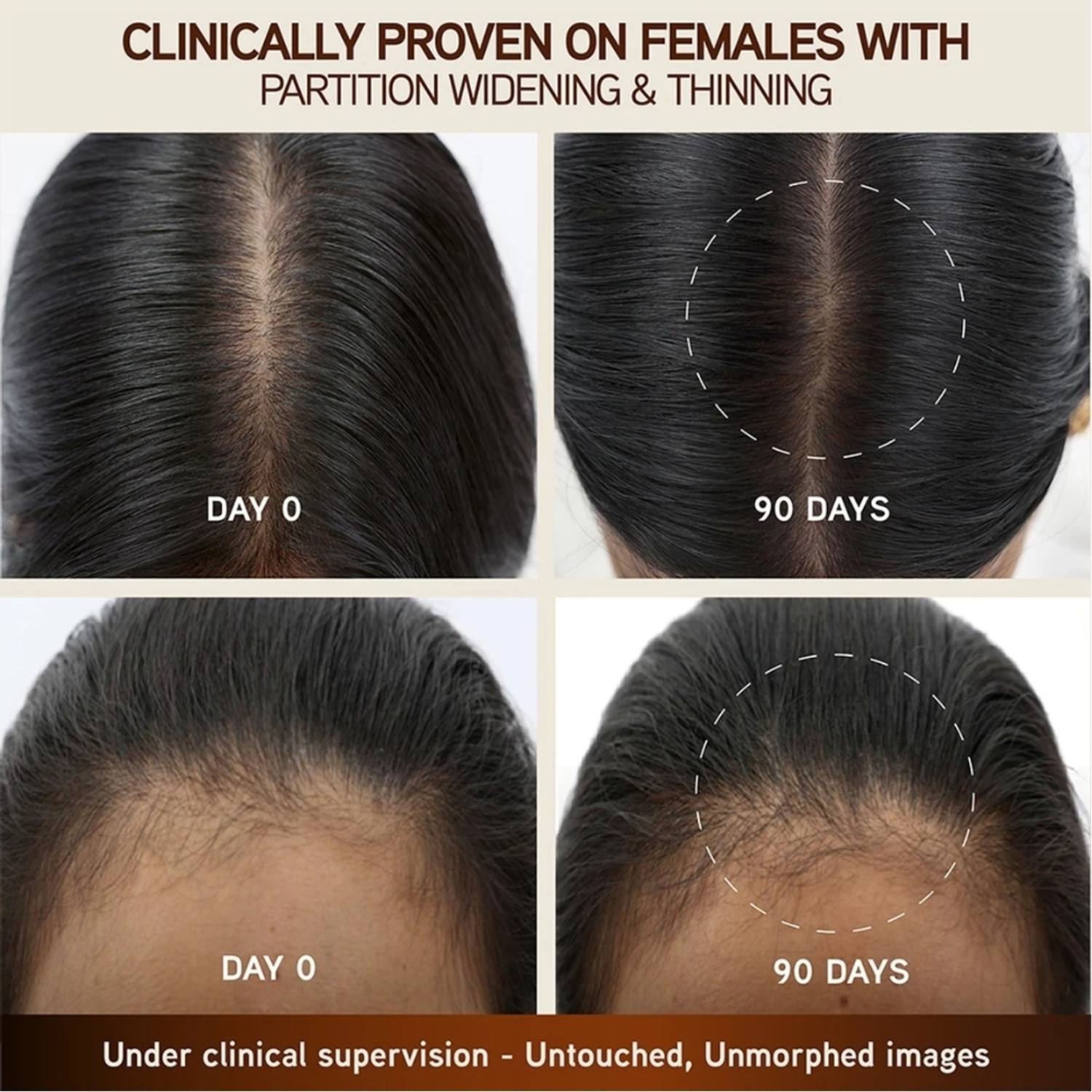 Image of indulekha Bringha Hair Growth Treatment Scalp Hair Boost Serum (30 ml)