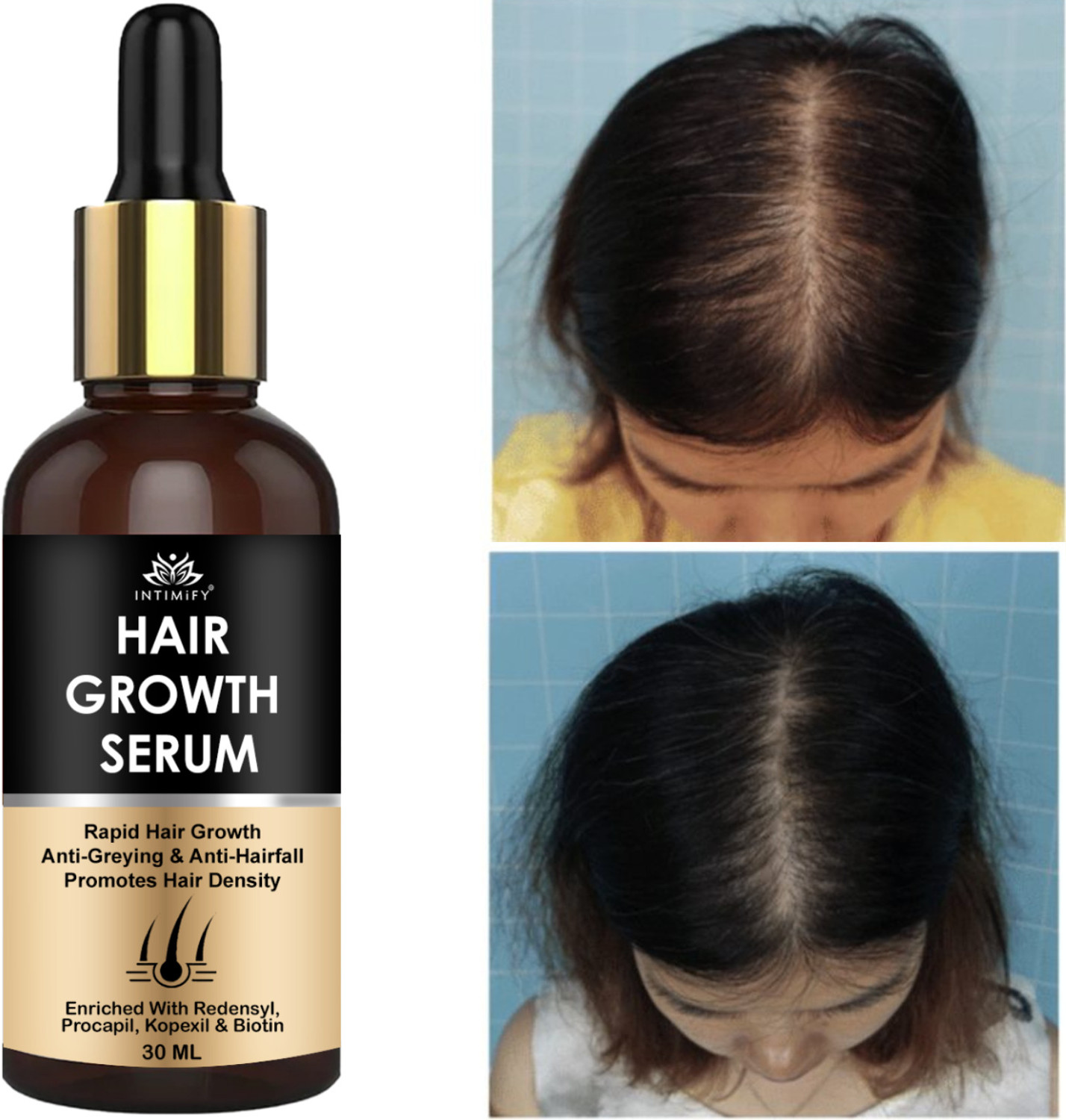 Image of Hegza Hair Growth Serum with 3% Redensyl, Anagain & Rosemary (50 ml)