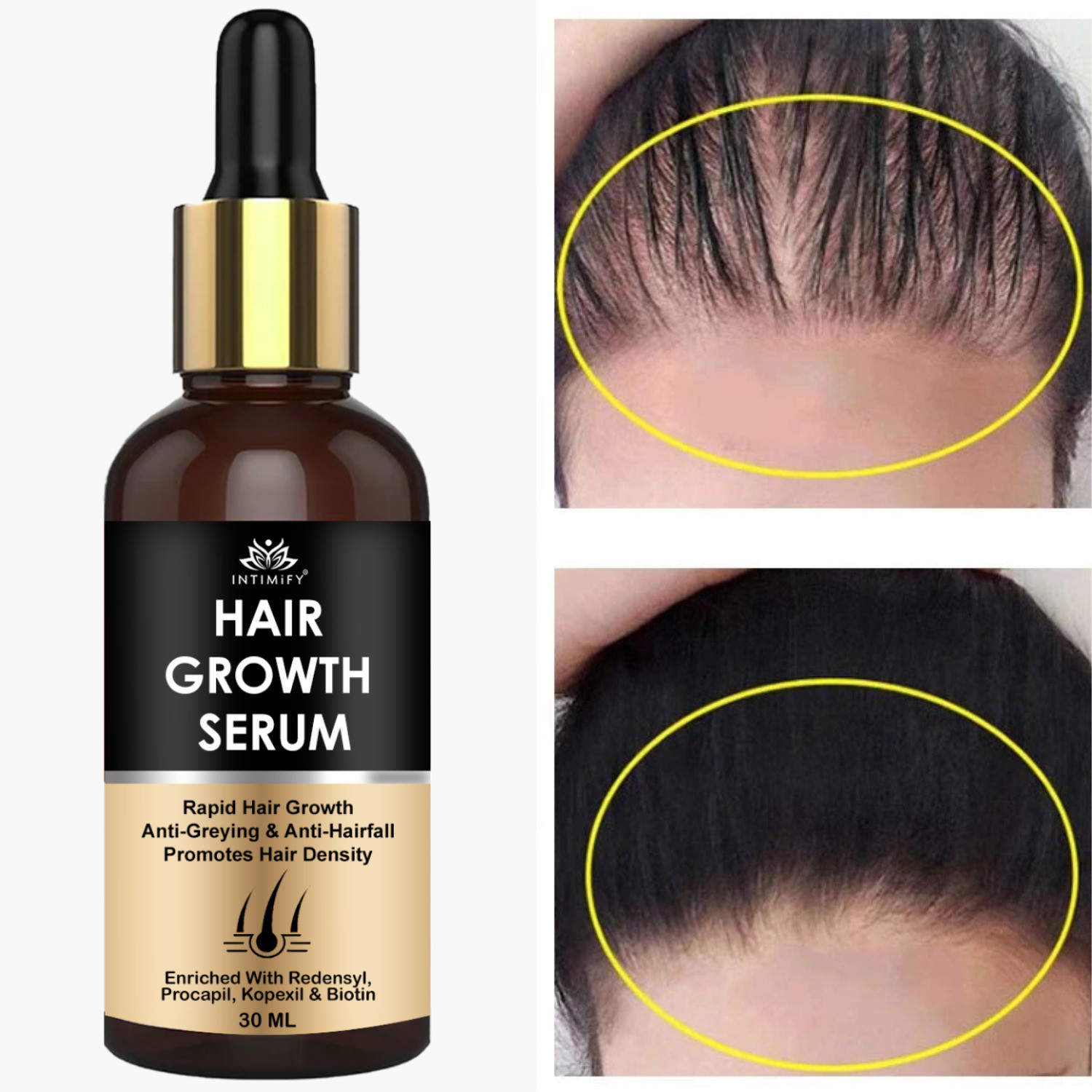 Image of Hegza Hair Growth Serum with 3% Redensyl, Anagain & Rosemary (50 ml)
