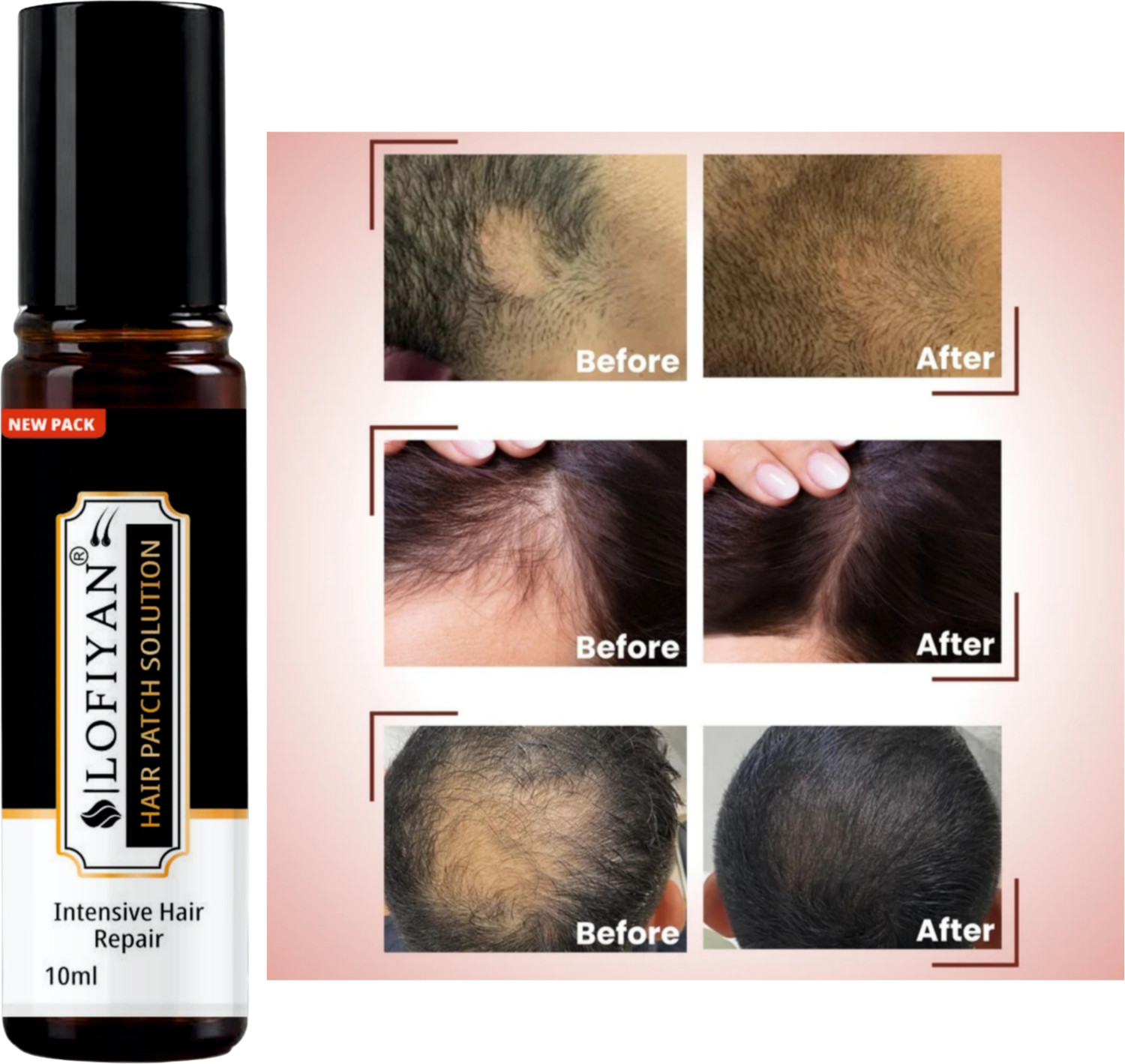 Image of TUMR Professional Keratin Moisturizing & Smooth Hair Mask Cream (1000 ml)