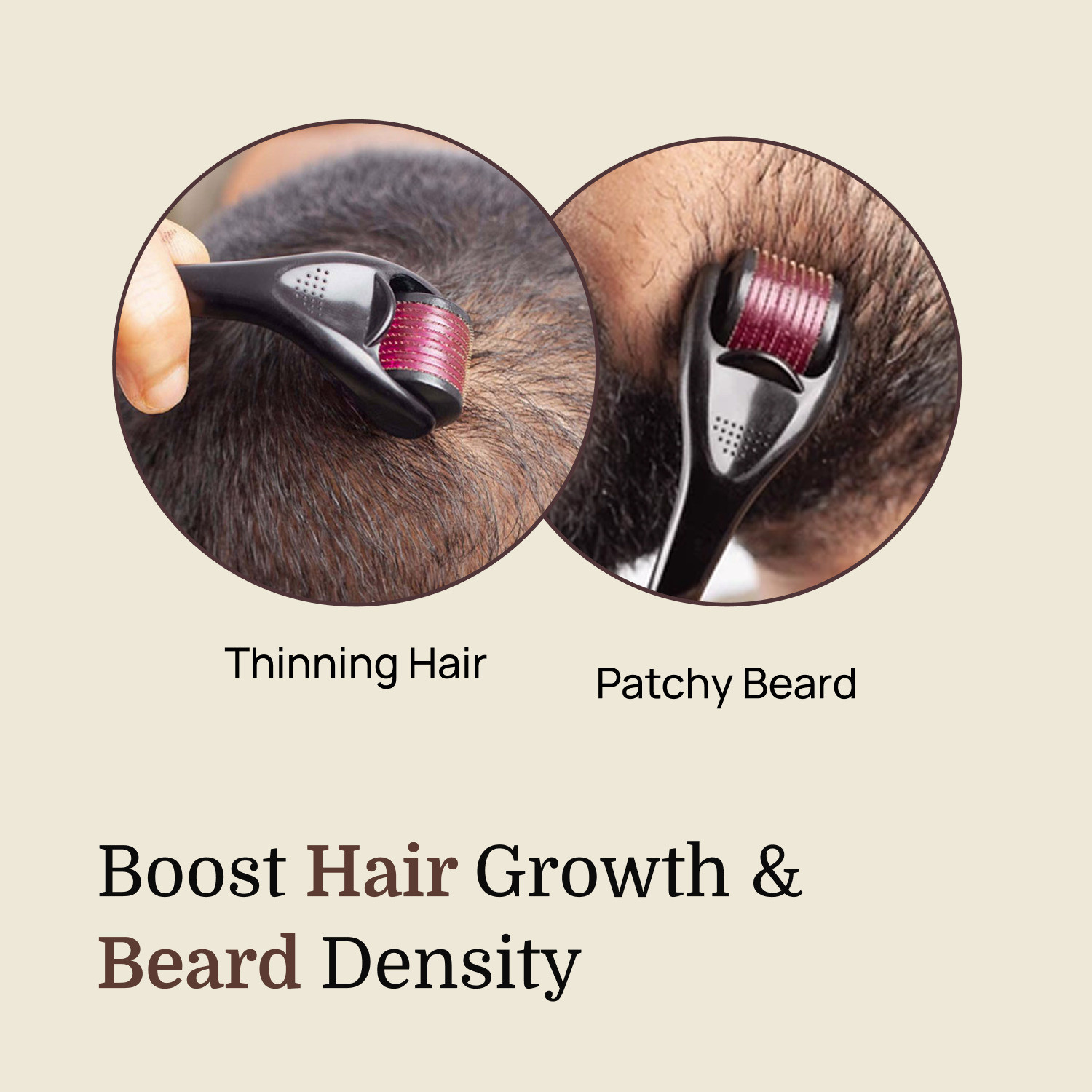 Image of Formen Derma Roller for Hair & Beard Growth 0.5mm | 540 Stainless Steel Needles for Hair Regrowth (Pack Of 3) (180 g)