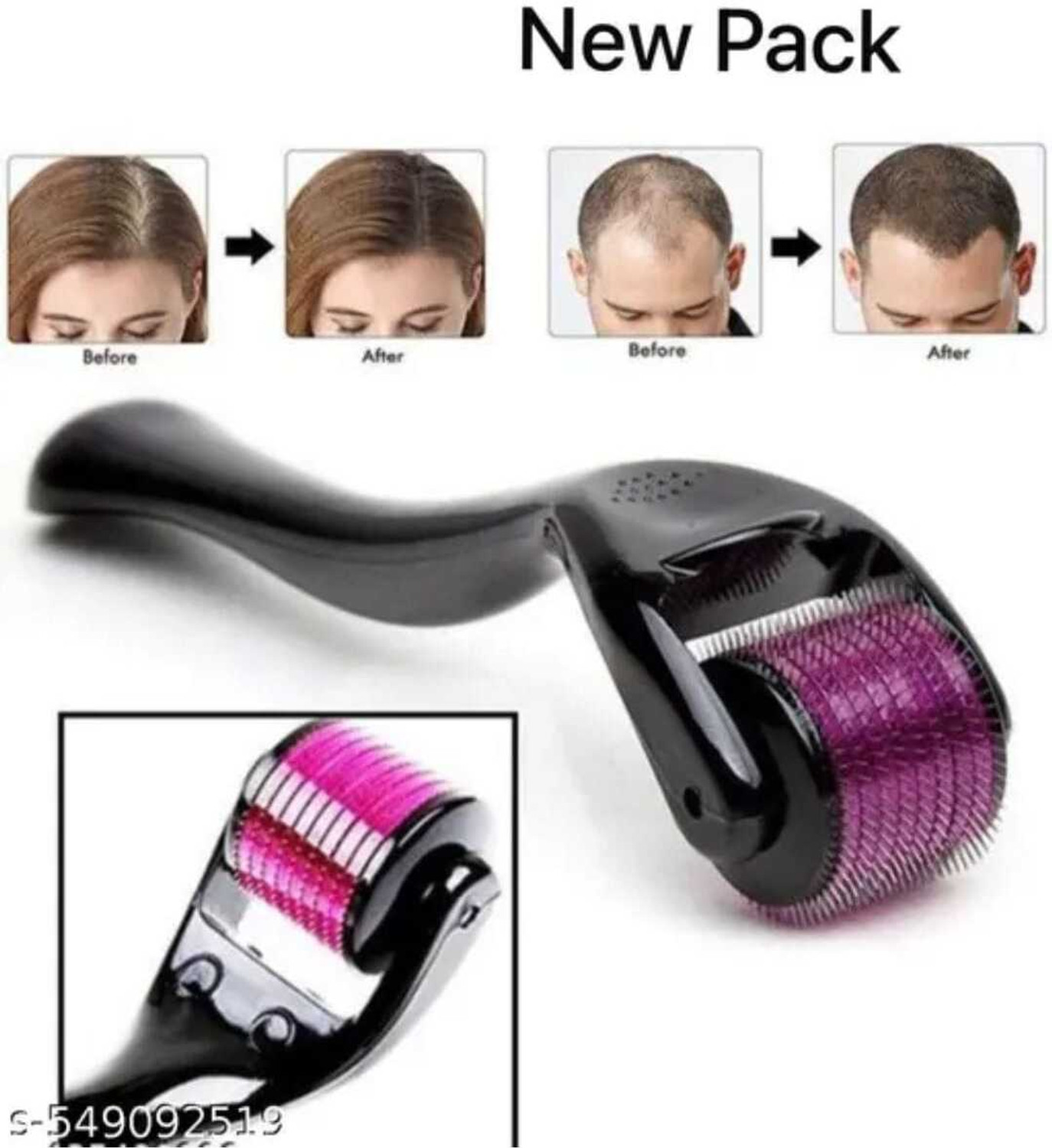 Image of Morbee Premium Derma Roller 0.5mm 540 Micro Needles For Hair Growth.10 (2 g)