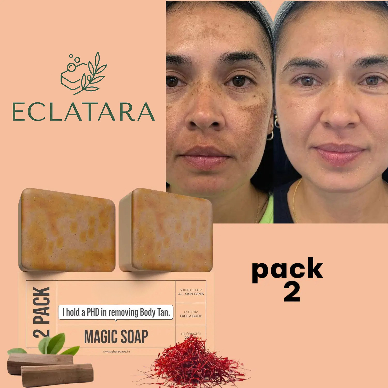 Image of Wild Stone Soap Combo (2 Ultra Sensual,2 Forest Spice, 2 Musk ) (600 g)