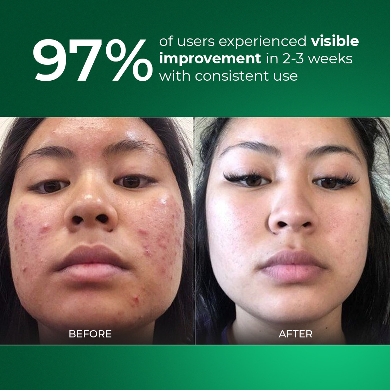 Image of Aqueria Sunscreen - SPF 50 PA++++ Oil Control Brightening French Multi-Active SPF | 2% Niacinamide, Salicylic Acid (50 g)