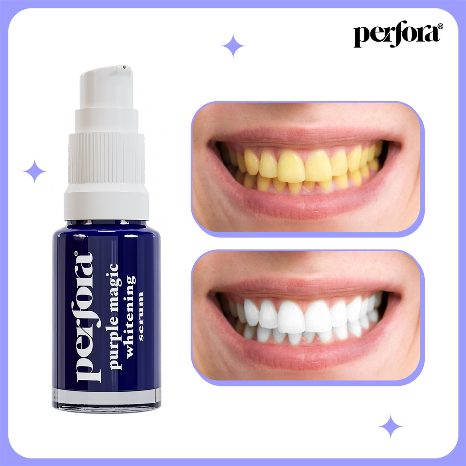 Perfora Purple Teeth Whitening Toothpaste Serum 10ml - Image 6