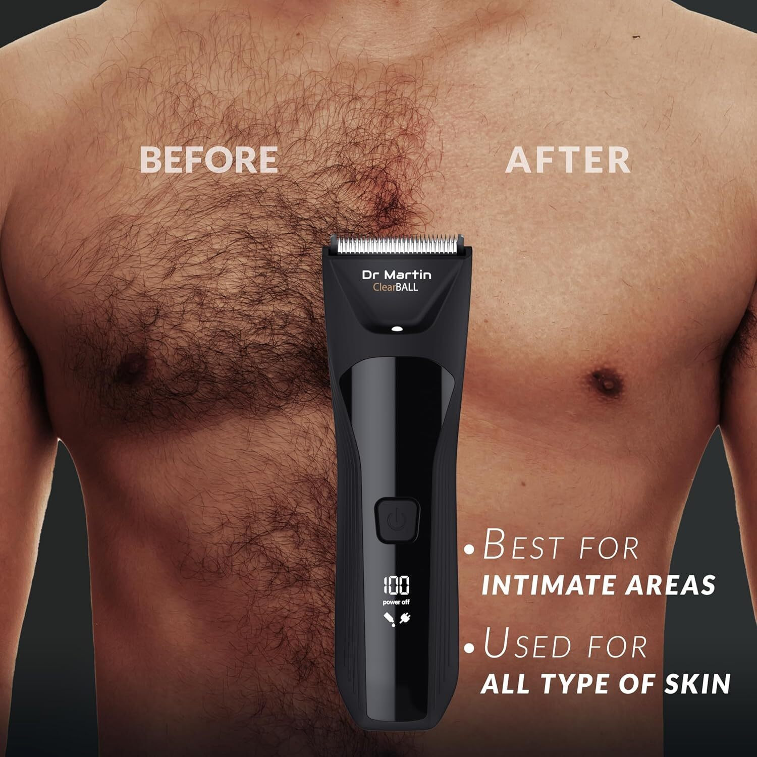 Image of DR MARTIN Man Body Grooming Trimmer For Private Part, Beard, Pubic Hair Fully Waterproof Fully Waterproof Body Groomer 90 min Runtime 5 Length Settings (Black)