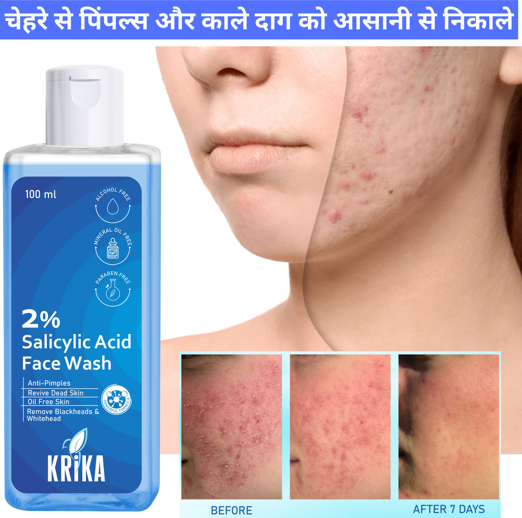 krika SALICYLIC ACID FACEWASH 100ML Face Wash