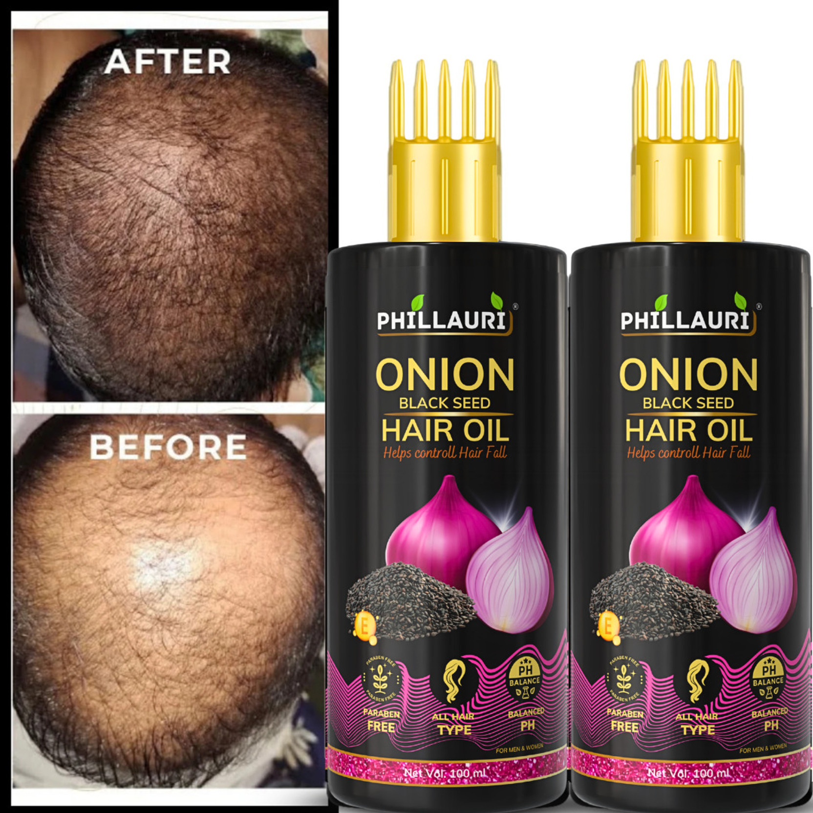Phillauri Onion Black Seed Hair Oil Men & Women Long Hair - Hair Regrowth beautifull Hair Oil