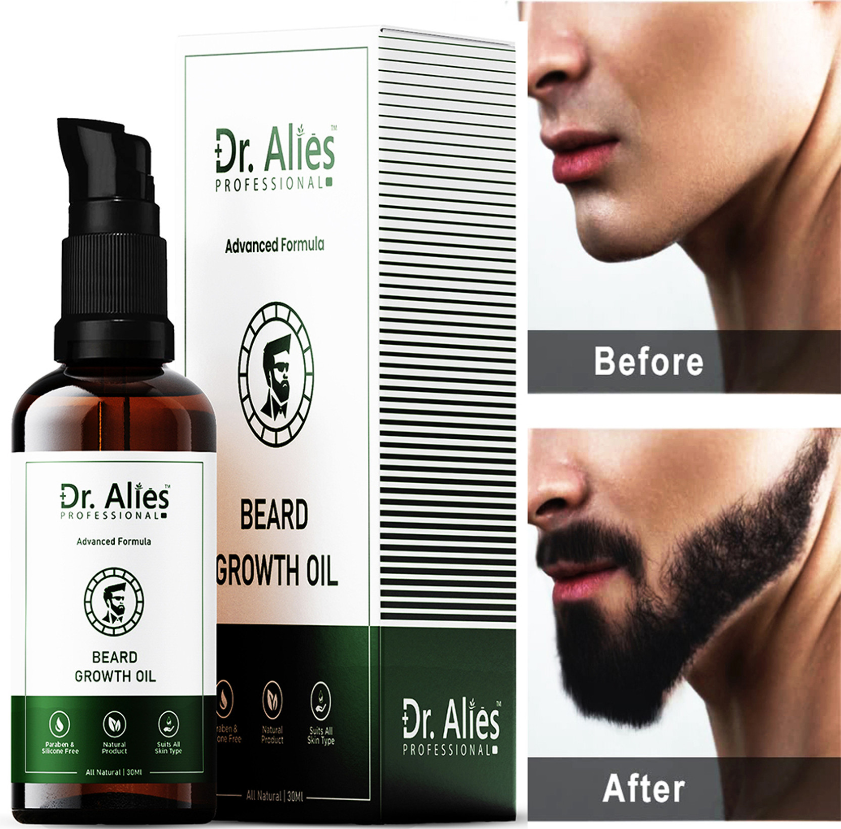 Dr. Alies Professional Premium Beard Growth Oil for Strong and Healthy Beard Growth - No SLS, No Paraben Hair Oil (30 ml) Hair Oil