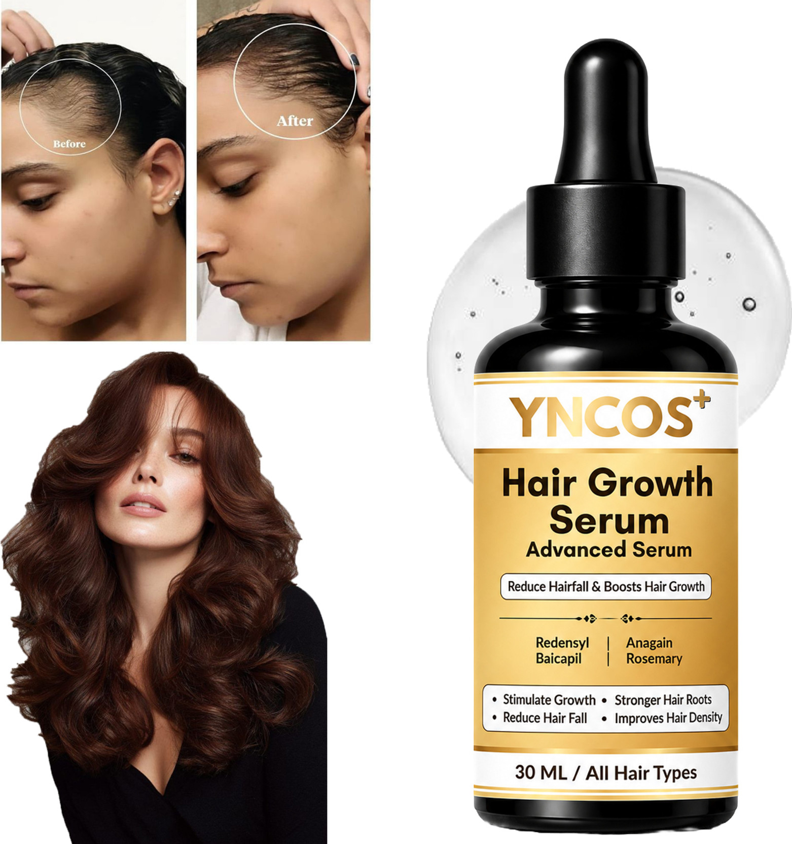 YNCOS Advanced Hair Growth Serum | 3% Redensyl + 4% Anagain + 3% Baicapil & Rosemary
