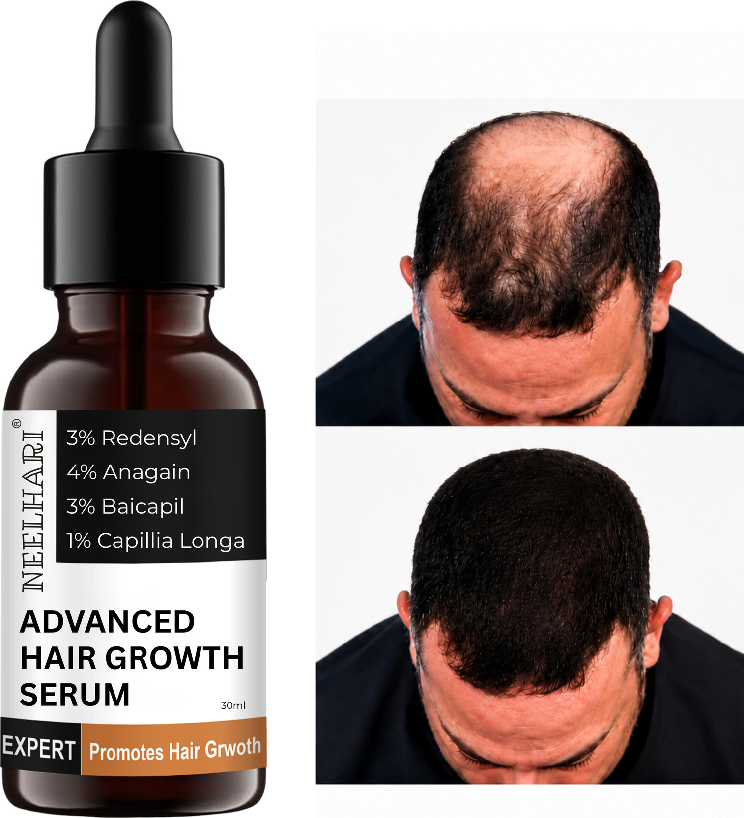 NEELHARI Advanced Hair Growth Serum for Men & Women | Makes Hair Smooth, Soft & Shiny
