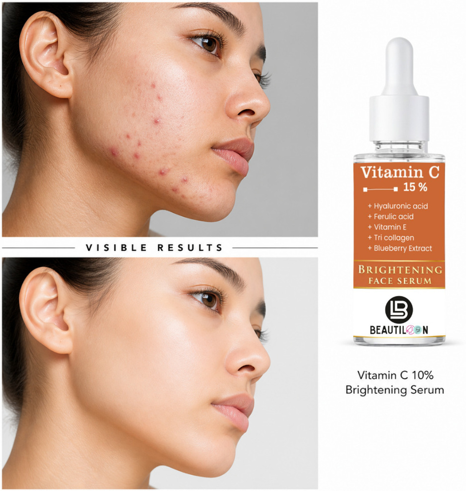 beautiloon 15% Vitamin C Brightening Face Serum for Dull Skin Dark Spot Removal Pigmentation Correction Acne Scar Treatment Fine Lines Wrinkles Open Pores Tightening Skin Repair Deep Hydration Smooth 