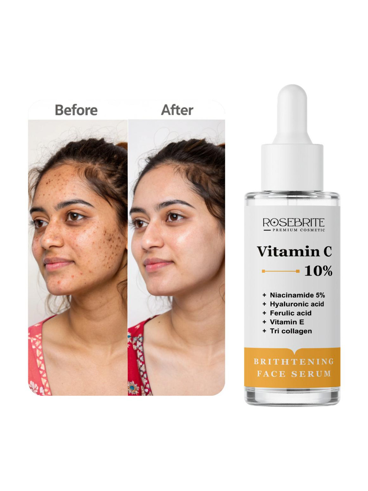 RoseBrite Vitamin C Dark Spot Corrector – Reduces Pigmentation, Evens Tone & Enhances Glow for Brighter, Clearer Skin