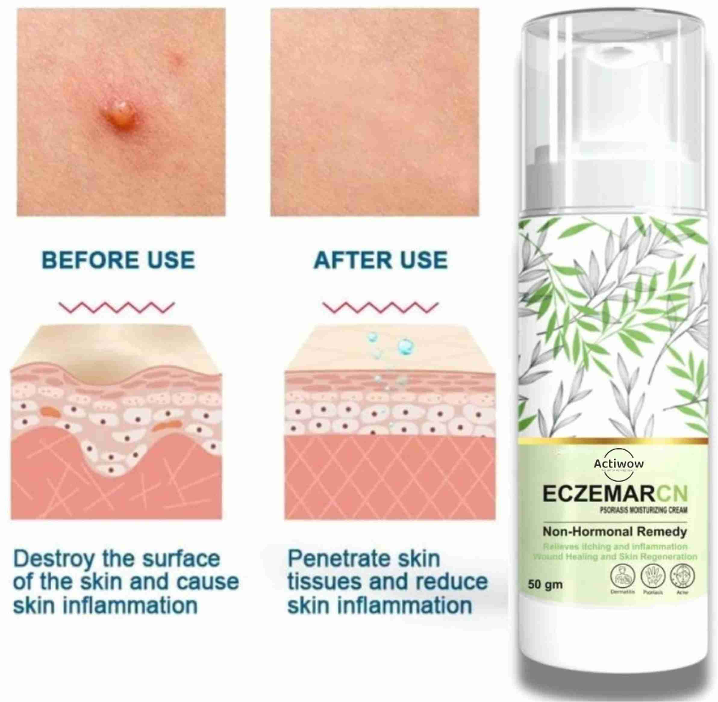 ACTIWOW Eczemaron Fungal Relief for Eczema – Soothing Cream for Itchy ...