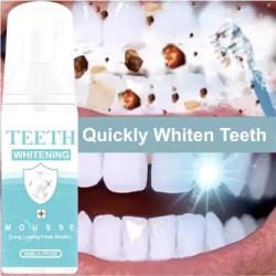  Crest 3D Whitestrips, Radiant Express with LED