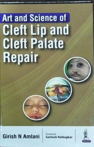 Art and Science of Cleft Lip and Cleft Palate Repair: Buy Art and ...