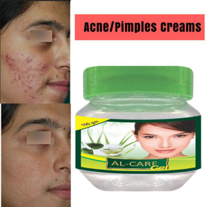 aloe shea butter Aloe Vera Whipped Shea Butter main image 0