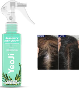 YeoJi Rosemary Water Spray for Hair Growth – Daily Strengthening Formula Hair Spray