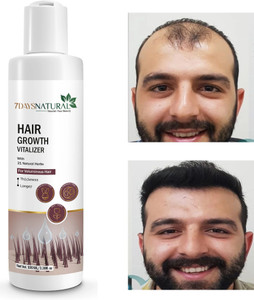 7days natural Hair Growth Vitalizer for Thickerand Healthier Hair