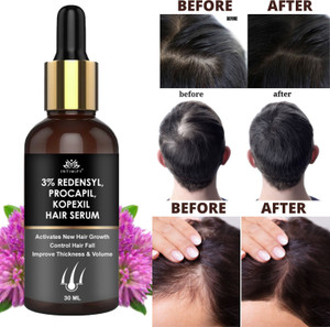 Intimify 3% Redensyl Hair Growth Serum 30ml - Image 5