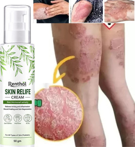 Renthol Skin Relife Ayurvedic Anti Fungal Cream | Ringworm & Eczema Relief | 50g