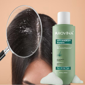 Arovina Anti Dandruff Shampoo 119 with Salicylic Acid & Biotin for Men