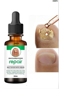 ONDPS Fungal Nail Treatment Liquid | Repair & Removal Solution nail growth serum