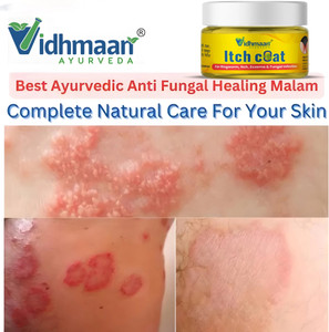 vidhmaan ayurveda ITCHCOAT Marham AntiFungal Ointment - Effective for Khujali & Fungal Infections