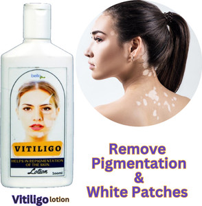 vitiligo and glutathione is an autoimmune condition that causes the loss of skin pigment, resulting in lighter patches of skin. It affects people of all ages, skin tones, backgroundsand while it isn't contagious BelloMe Melanin restoration lotion |