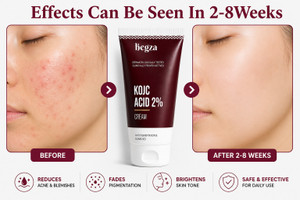 Hegza Anti Pigment Skin Cream Dark Spot Removal Cream for Pigmentation, Dull Skin & Wrinkles| Brightening Face Cream