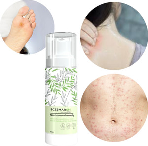 Eczemaron Ringworm Fungal Cream For Men & Women