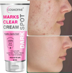 cosmofine Marks Clear Cream, Removes Scars & Marks Dark Spot Removal Cream For Women & Men