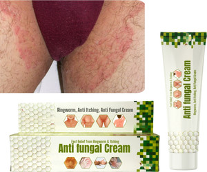 LILIPATI Anti Fungal Cream for Daad Khaj Khujli, Ringworm & Skin Infection Relief | Ayurvedic Itching Cream
