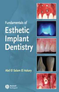Fundamentals of Esthetic Implant Dentistry 2 2nd  Edition