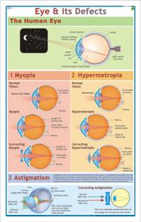Eyes : Defects & Remedies Chart Paper Print