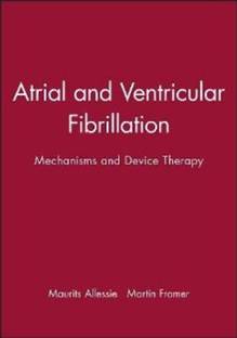 Atrial and Ventricular Fibrillation