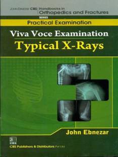 John Ebnezar Cbs Handbooks in Orthopedics and Factures:Practical Exami