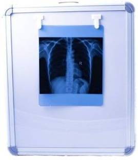 BrainWave LED X-Ray View Box with Automatic Film Activation and Variable Brightness Control (Single Film) X-Ray Viewer