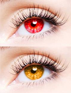 EYCOG Monthly Disposable