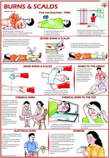 First Aid chart - Burns and Scalds Photographic Paper